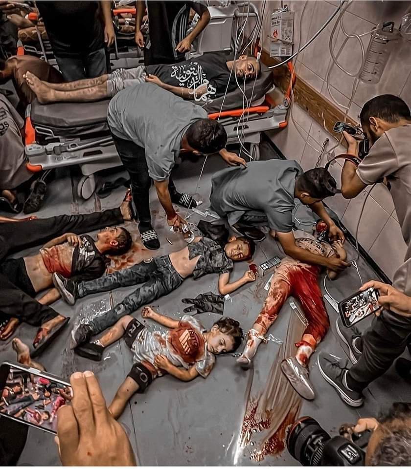 صورة من مستشفى شهداء الأقصى بعد قsف العدو الناس في سوق دير البلح الشعبي 😢