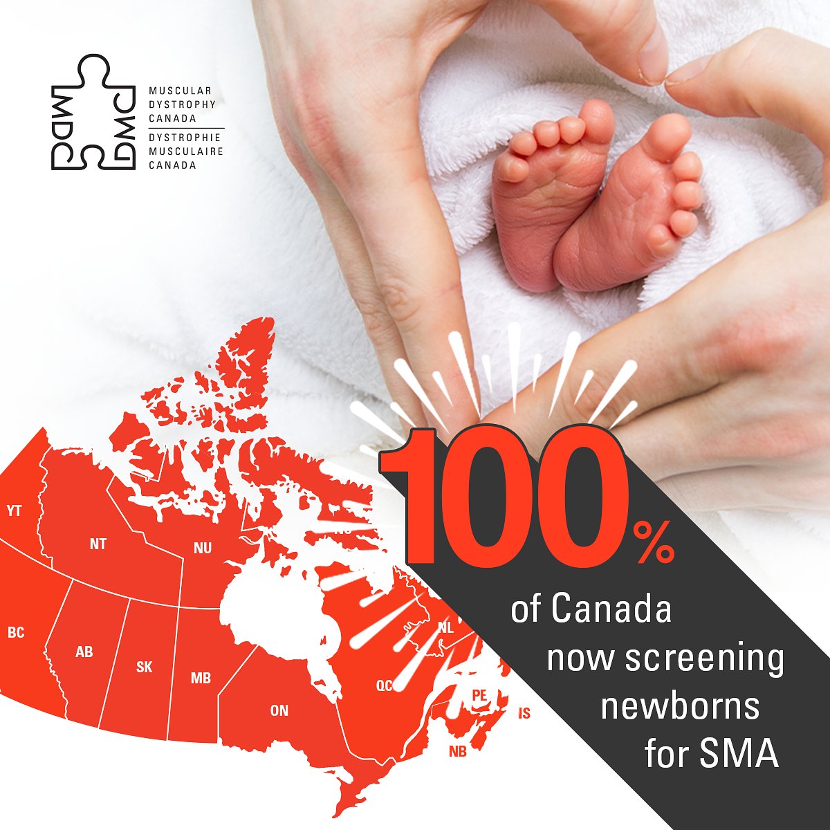 MD_Canada's tweet photo. In case you missed it, as of today 100% of provinces and territories in Canada are now screening for spinal muscular atrophy (SMA).
Check out our news release here: https://t.co/GkJNbH5WOC https://t.co/cnTZwSF18y