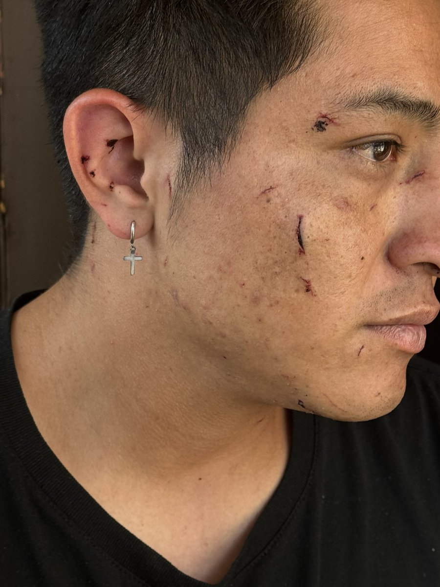 HardingReports's tweet image. A 30 year-old from Ecuador was attacked this morning in Newark - hit in the head with a glass bottle.  The victim says his attacker yelled something about not wanting Latinos here.  Newark investigators say the suspect attacked four men.  @NBCNewYork