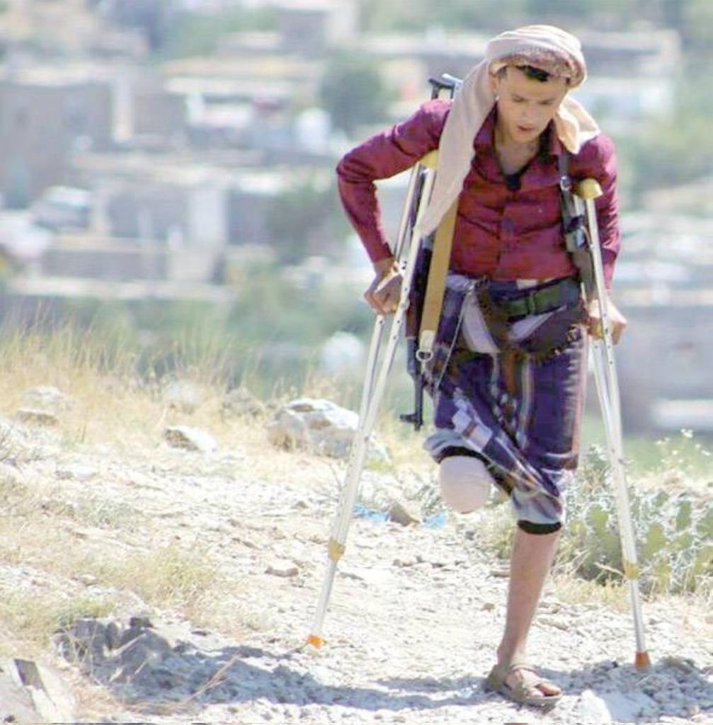 عزيزي المطبل اياك ان تطبل لمن 

خذل الجرحئ بعد اليوم حتئ لا يعود تطبيلك عليك ل ع نه.🇾🇪✌🏻