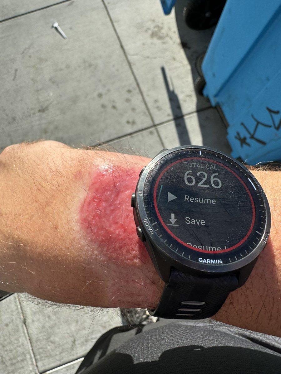 HTMarples's tweet image. 😰