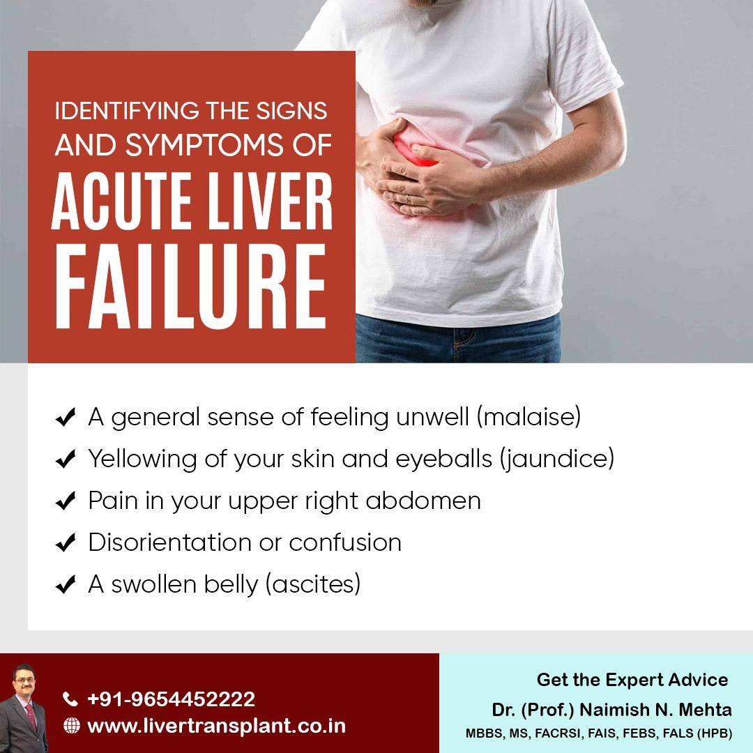 mehta_naimish's tweet image. Identifying the Signs and Symptoms of Acute Liver Failure:
- A general sense of feeling unwell (malaise)
- Pain in your upper right abdomen
- Disorientation or confusion
- A swollen belly (ascites)

#acuteliverfailure #liverproblem #liverspecialist #liverdoctor #drnaimishmehta