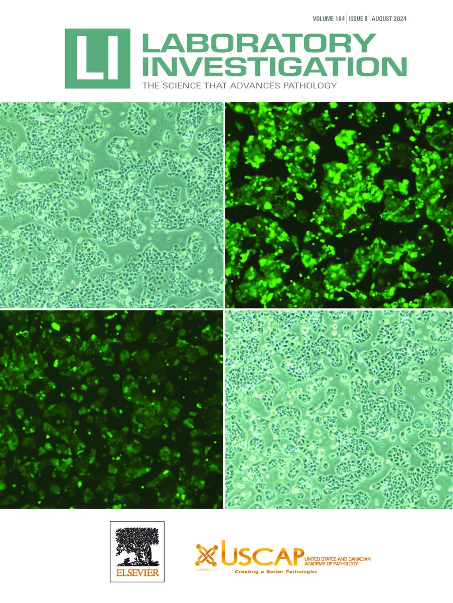 NEW AUGUST COVER!

Reference Manuscript:
"In summary, measuring the expression levels of COX7A1 in the clinic may be useful in predicting the prognosis of GC patients, the degree of chemotherapy resistance, and the efficacy of immunotherapy."

laboratoryinvestigation.org/article/S0023-…