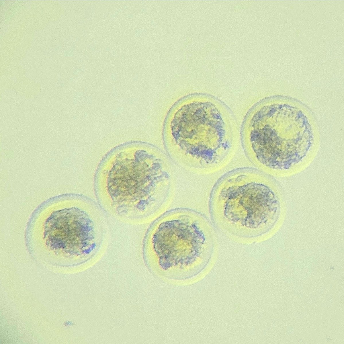 dairemarkham's tweet image. Back flushing after the summer break - lovely flush to get the ball rolling #embryotransfer #aberdeenangus #angus