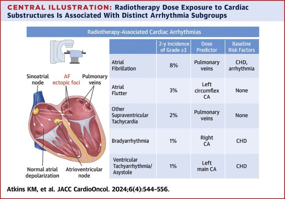 Just out @JACC CardioOncol, we intricately map #radiation exposure from #radiotherapy for #LCSM to different sub-structures of the heart to predict the risk of 5 different classes of #cardiac arrhythmias, pointing to possibly distinct pathophys pathways.   sciencedirect.com/science/articl…