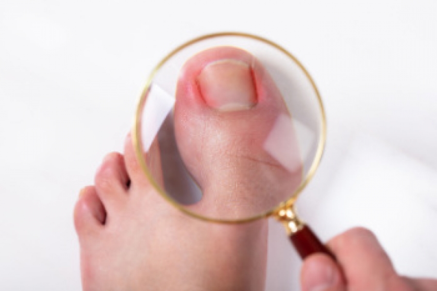FSSTexas's tweet photo. What to Do With an Ingrown Toenail https://t.co/StnsdUVrFy https://t.co/hXnpdHeGCB