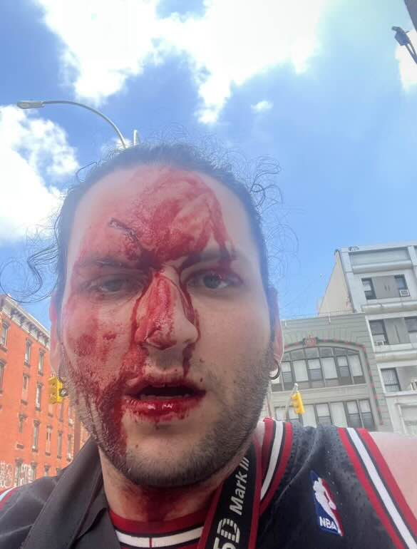 LightningFilms's tweet photo. MrBased attacked Youtuber Alex Novell. MrBased has been located and surrounded by five undercover detectives for alleged murder...

He says he will jump off the Brooklyn Bridge because of @KEEMSTAR take on the subject. Absolutely pathetic. 

Source: @DramaAlert @KEEMSTAR https://t.co/cpeClvCM4A