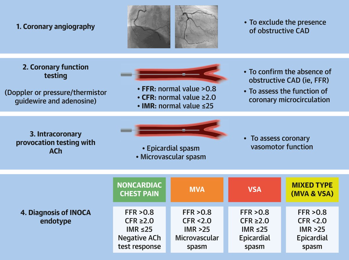 🆕 #JACC state-of-the-art review highlights a shift toward a more tailored approach in the management of stable angina by performing a precise endotype diagnosis in patients with INOCA. 

👀 Read more: bit.ly/3X6Ttr9