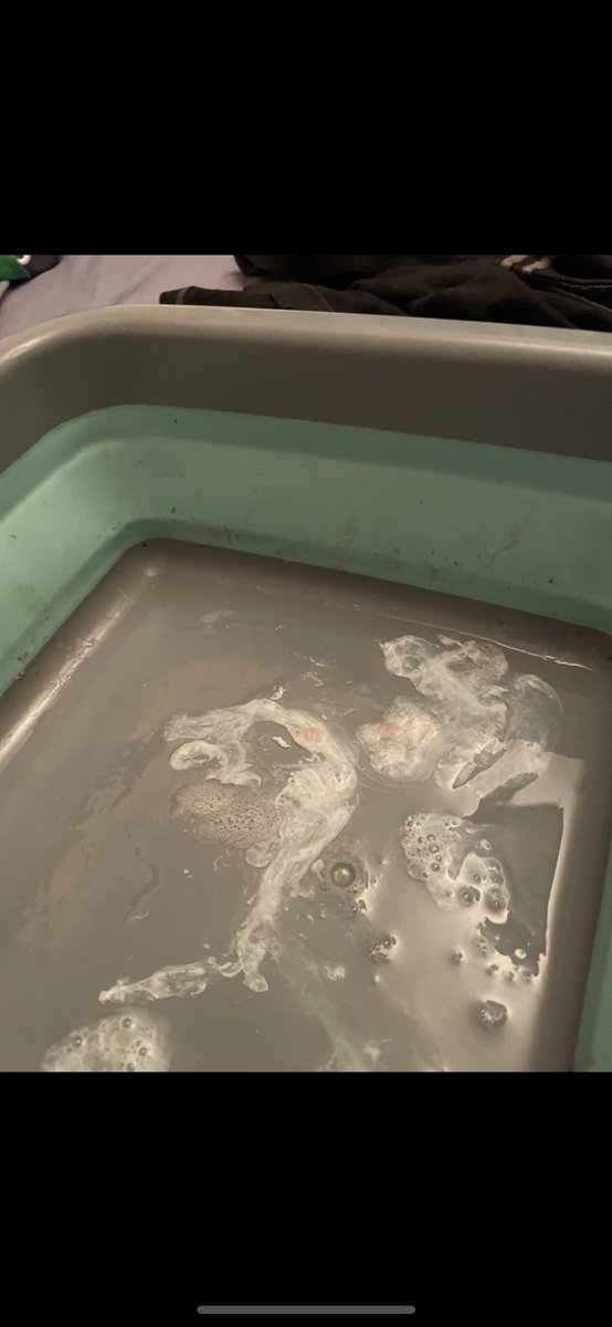 Macseano's tweet photo. Please ask your professors how on earth this was even formed from a
Tub full of my phlegm @Cambridge_Uni @UniofOxford  #FreakyHawktuah https://t.co/GzjN3d0PQK