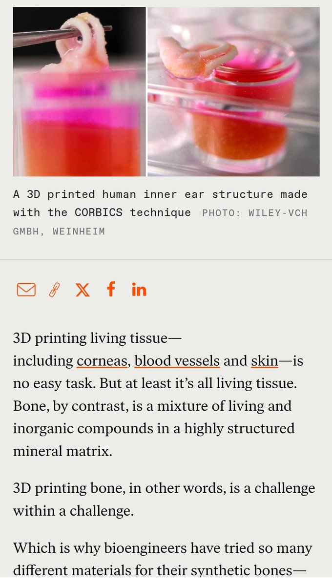 IanHurn0's tweet photo. 3D Printing Bone Directly Into the Body A novel ink enables bioengineers to print bone-like material at room temperature with living cells

#cyborgtissue
#3dorgans
#cyborgorgans

https://t.co/TSETeozMVp https://t.co/ERqOeIO2aN