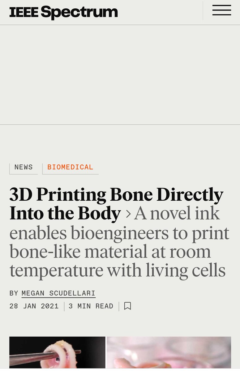 IanHurn0's tweet photo. 3D Printing Bone Directly Into the Body A novel ink enables bioengineers to print bone-like material at room temperature with living cells

#cyborgtissue
#3dorgans
#cyborgorgans

https://t.co/TSETeozMVp https://t.co/ERqOeIO2aN