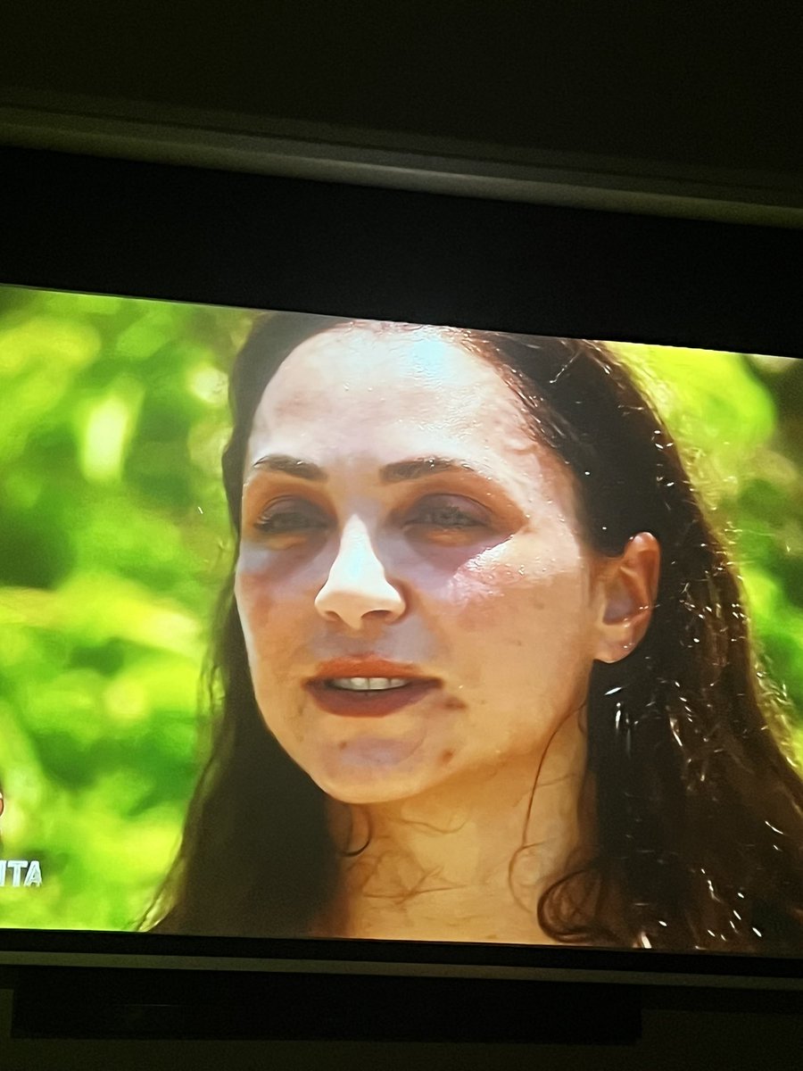si0n3's tweet photo. C’est moi ou on dirait une crack head #KohLanta https://t.co/xuSA7q8Dve