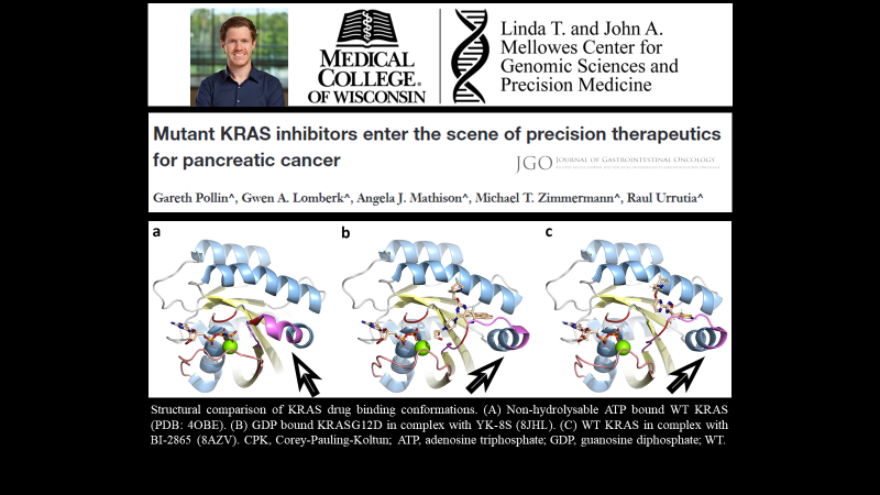 Gareth Pollin (@gpollin94) on Twitter photo New publication in #PancreaticCancer: Precision therapeutics of KRAS.
jgo.amegroups.org/article/view/8…
<a href="/letswinpc/">Let's Win Pancreatic Cancer 💜</a> <a href="/PanCAN/">PanCAN</a> <a href="/lustgartenfdn/">Lustgarten Foundation</a> <a href="/MCWPancProgram/">MCW LaBahn Pancreatic Cancer Program</a> <a href="/RareCancerRF/">Rare Cancer Research Foundation + Pattern.org</a> <a href="/P_C_E_/">Pancreatic Cancer Europe (PCE)</a> <a href="/apapancreas/">American Pancreatic Association</a> New publication in #PancreaticCancer: Precision therapeutics of KRAS.
jgo.amegroups.org/article/view/8…
<a href="/letswinpc/">Let's Win Pancreatic Cancer 💜</a> <a href="/PanCAN/">PanCAN</a> <a href="/lustgartenfdn/">Lustgarten Foundation</a> <a href="/MCWPancProgram/">MCW LaBahn Pancreatic Cancer Program</a> <a href="/RareCancerRF/">Rare Cancer Research Foundation + Pattern.org</a> <a href="/P_C_E_/">Pancreatic Cancer Europe (PCE)</a> <a href="/apapancreas/">American Pancreatic Association</a>
