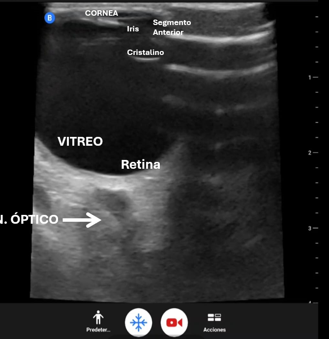 AvelRomanNeph's tweet photo. Us Ocular
Con mi #ButterflyiQ3
recuerden que @UsButterflyMx tiene uno para envio inmediato 🧐 https://t.co/zrgXx2lpAS