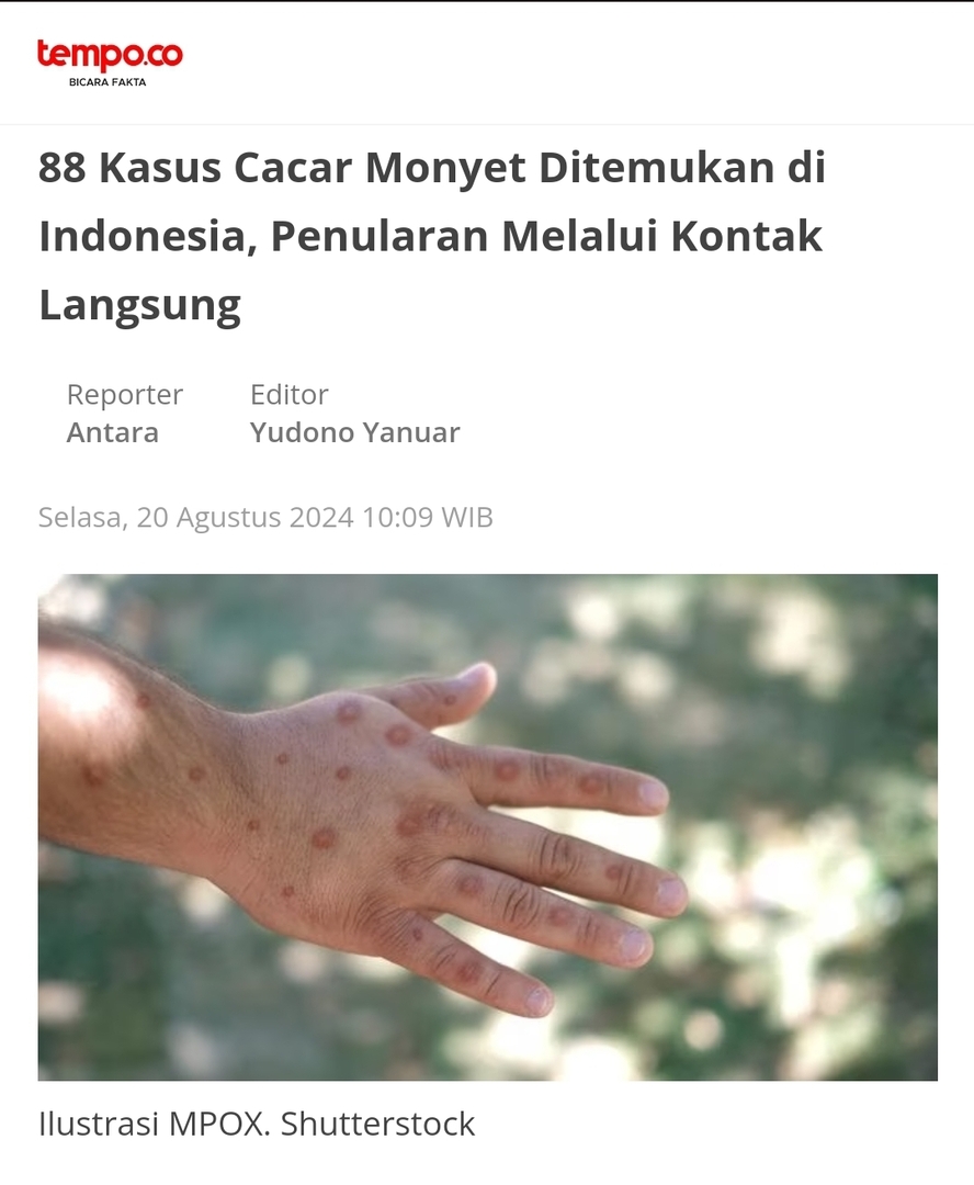 - 59 kasus di DKI Jakarta
- 13 kasus di Jawa Barat
- 9  kasus di Banten 
- 3 kasus di Jawa Timur
- 3 kasus di DIY
- 1 kasus di Kepulauan Riau.

💚 kalau punya gejala kayak cacar segera ke dokter dan isolasi di rumah ya. STAY SAFE GUYS!