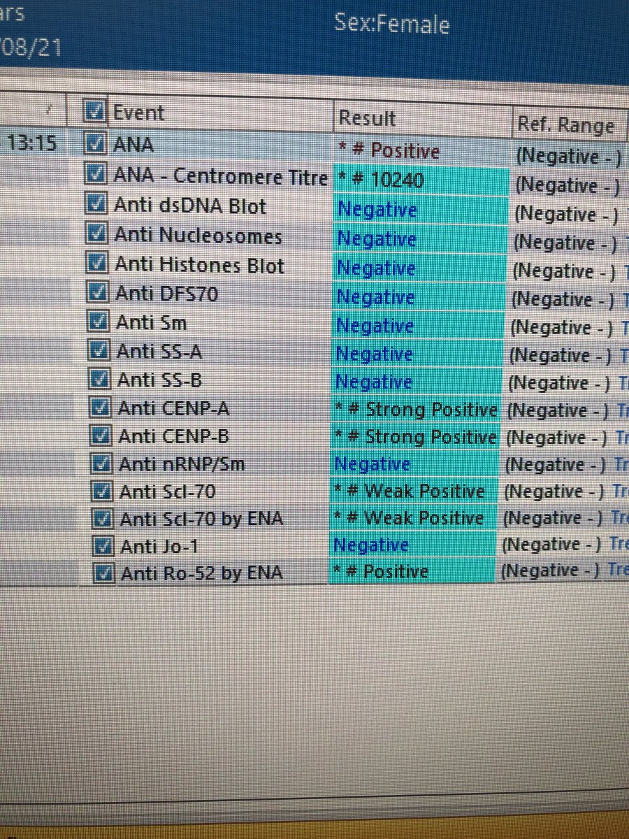 Janetbirdope's tweet photo. #ClinicalPearl
you can have #anticentromere rarely with #anti-topoisomerase1 / #Scl70

#scleroderma #SSc https://t.co/aGx0NcErPP