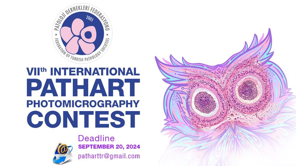 Our famous #PathArt contest is back! 
Cannot wait to see your beautiful artwork!

Entry details and contest rules can be found at turkjpath.org/static.php?id=…

<a href="/TurkJPath/">Turkish J Pathology</a> <a href="/PatoDernFed/">Patoloji Dern Fed</a> <a href="/glinglerimek/">gulcin guler simsek, MD</a> <a href="/DrSultanClskn/">Sultan Çalışkan, MD</a> <a href="/Usubutun/">Alp Usubutun</a> <a href="/sirinozr/">şirin küçük</a> <a href="/path_dr_vildan/">Dr.Vildan E.</a> <a href="/Usubutun/">Alp Usubutun</a>