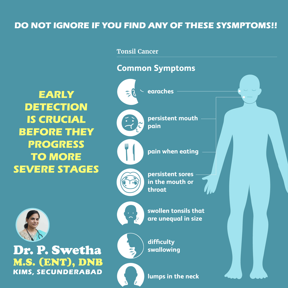 DrSwethaENT's tweet photo. Tonsil Cancer!! Don’t let the pain control your life before it is severe!!

Consult today! 

#Hyderabad #HyderabadRains #Telangana #Secunderabad #Throat #TonsilsTreatment #Throatcare #Doctor #Coblation #Adenoids #BestENTHospital #ENTHospital #ENT #TonsilCancer #Trending #viral https://t.co/iFXADSw698