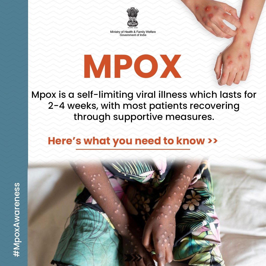 PIB_India's tweet photo. MPOX 🚨

▶️ #Mpox is a viral illness that can be managed with supportive care. Learn how it spreads, recognize the symptoms, and follow these prevention tips 

Here is what you need to know!👇

#MpoxAwareness  @MoHFW_INDIA  @MIB_India  

(1/4)