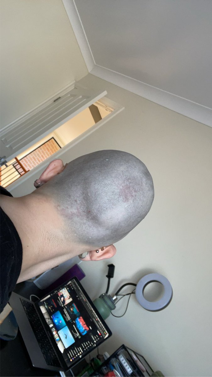 VeeVeeGroove's tweet photo. Who wanna see my fuckin cranium https://t.co/1N7kzOUT07