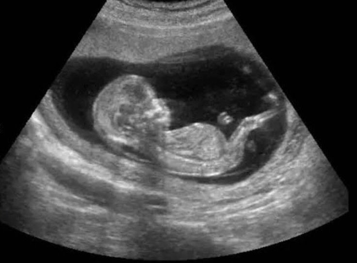 No queremos que se derrame más sangre inocente, no queremos que se desproteja más a las mujeres, no queremos que en el que se hizo llamar gobierno de la Vida, se siga despreciando las vidas de los más indefensos.

#AbortoNoEsSalud