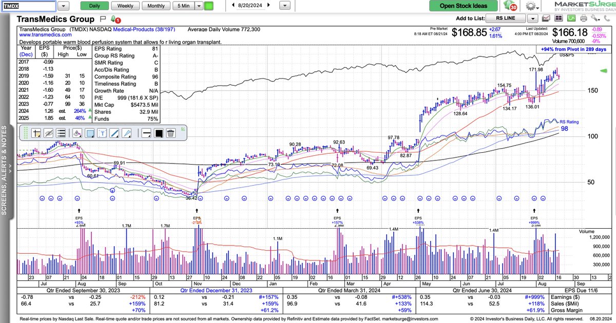$TMDX TMDX This medical product stock is trading nearly 2% higher in pre-market action. TransMedics Group Initiated at Buy by Needham. TransMedics Group Price Target Announced at $208.00/Share by Needham.