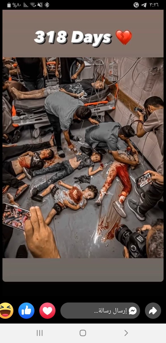 طب شو ضل شو مطلوب يصير عشان تتحركو يا تعريص يا اسوء عالم 🚶‍♂️
وطن عربي معرص مطبع خاين كل كل الوطن العربي خاين 🚭
كيف الصورة بس ..... 
لكي الله يا غزة