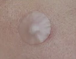 slfiadwiast__'s tweet photo. Aku klo lagi jerawatan suka pake Kye Acne Patch buat ngilanginnya, soalnya ampuh bgt buat jerawat bernanah 💞 https://t.co/kcmpieknsl