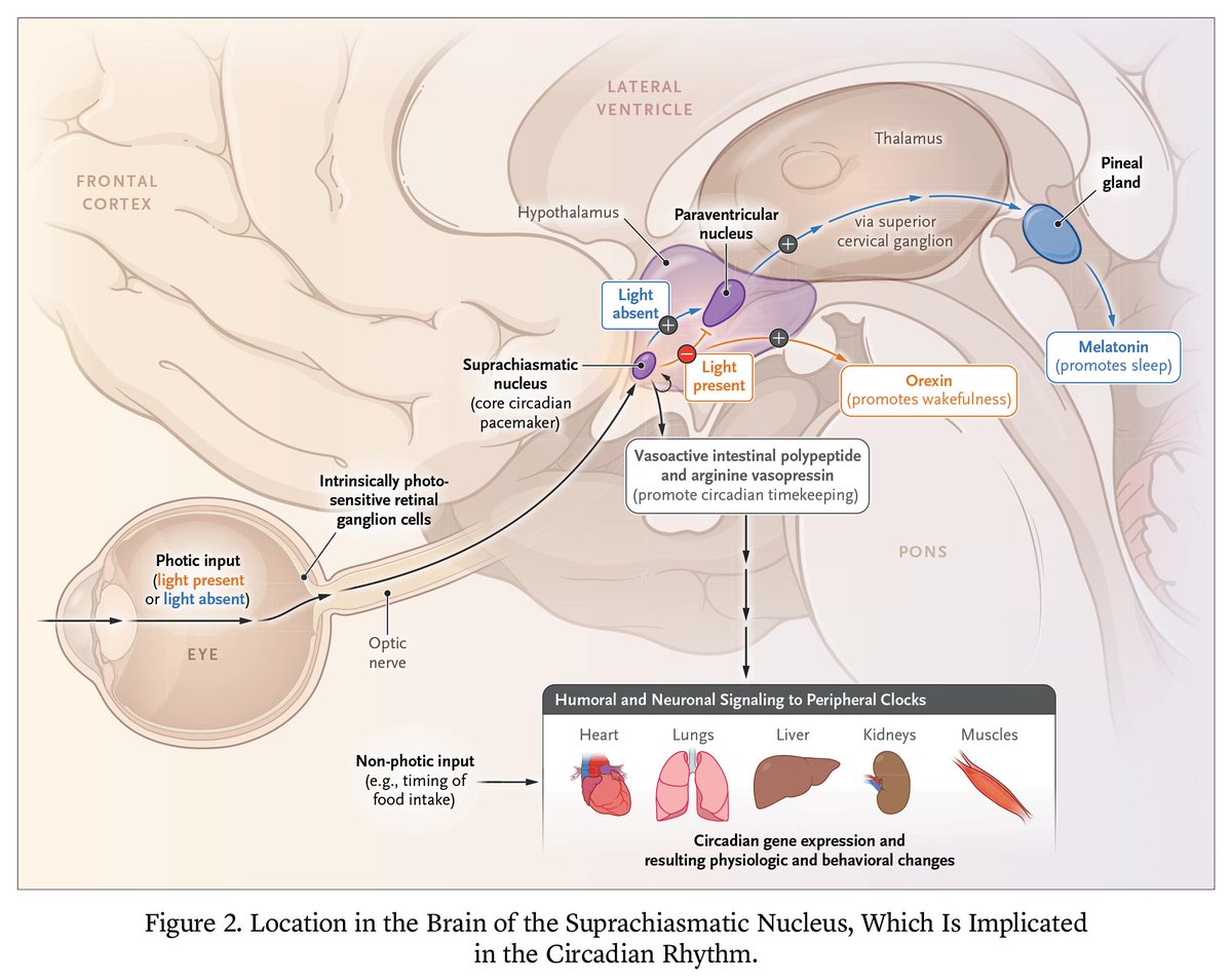NEJM Evidence (@nejmevidence) on Twitter photo Many individuals fall short of their biological need for sleep many nights of the week.️ In this article, the authors review the architecture of sleep, evidence for sleep health & strategies for improving sleep health. 🔗 eviden.cc/4fc7hrm <a href="/harvardsleepmed/">Harvard Medical School Division of Sleep Medicine</a> <a href="/rebeccasrobbins/">Dr. Rebecca Robbins (PhD)</a> Many individuals fall short of their biological need for sleep many nights of the week.️ In this article, the authors review the architecture of sleep, evidence for sleep health & strategies for improving sleep health. 🔗 eviden.cc/4fc7hrm <a href="/harvardsleepmed/">Harvard Medical School Division of Sleep Medicine</a> <a href="/rebeccasrobbins/">Dr. Rebecca Robbins (PhD)</a>