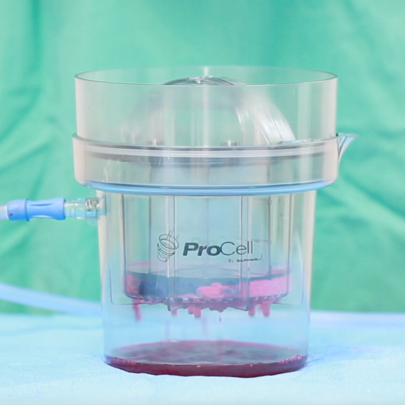 ProCell Surgical Inc. (@ProCellSurgical) / Posts / X
