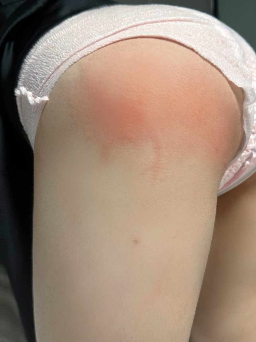 sweep24643's tweet photo. 来生理期不能做别的所以屁股轻轻的碎掉了…#les #女同 #打屁股 #sp 
挨打之前老婆说生理期也不能拍屁股除非找出医生允许的证明 居然真的打开百度开始搜索然后面不改色的告诉她医生建议多打屁股哈哈哈哈哈哈哈哈哈 https://t.co/oD4UcrIWKQ