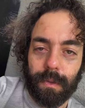 Vinicios Betiol tweet media