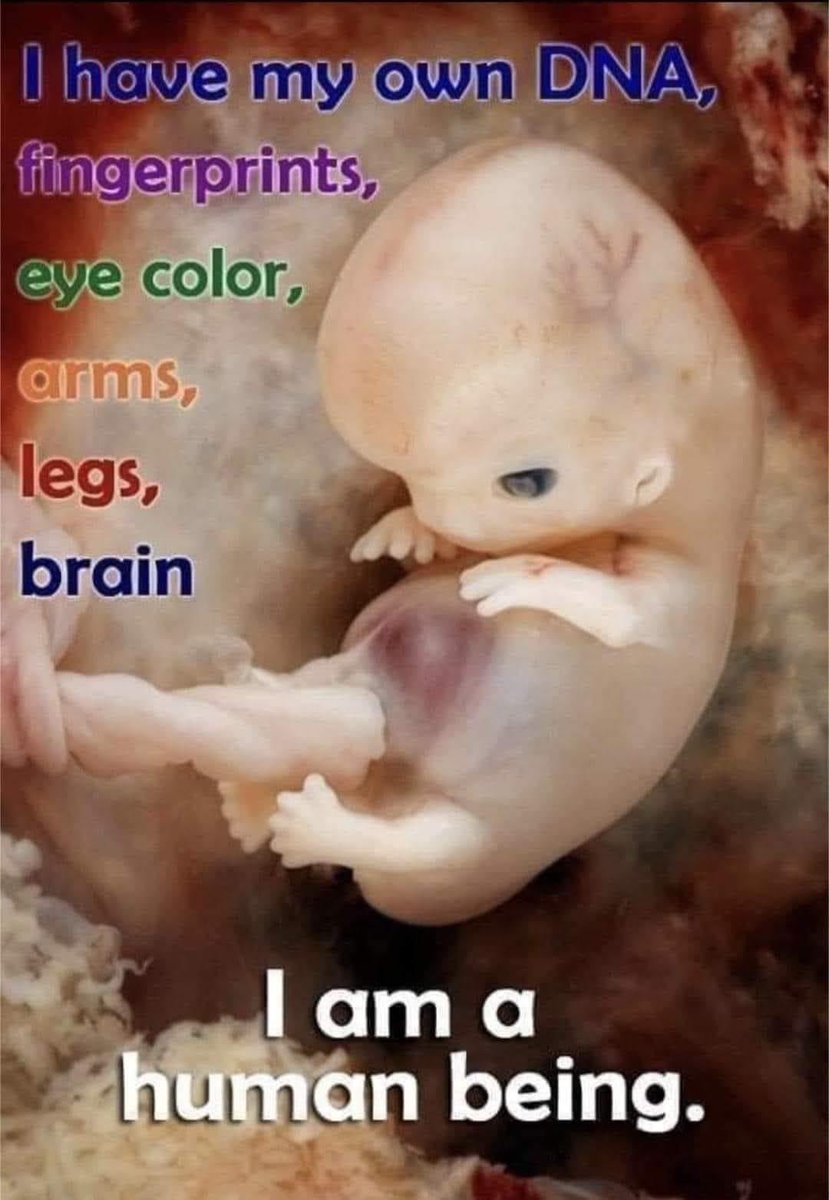 NansBlueHeavn3's tweet image. “Before I formed you in the womb I knew you,     before you were born I set you apart;     I appointed you as a prophet to the nations.”     Jeremiah 1:5 🌿
#prolife #lifeatthemomentofconception 
#GodsMiracles 
#babiesareblessings 
#chooselife #defendlife #abortionkills