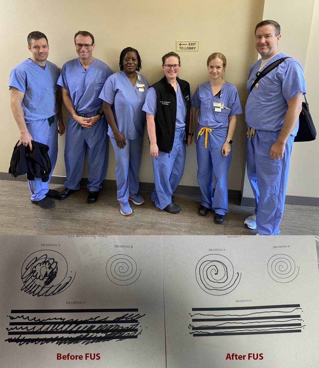 Dario J. Englot (@englot) on Twitter photo Exciting day today as our focused ultrasound (FUS) team successfully treated our first patients with disabling tremor at <a href="/VUMChealth/">Vanderbilt Health</a>! Tremendous tremor reduction in minutes with no incision or anesthesia, and very happy patients.
News blast: tinyurl.com/uepz4rmh
Upcoming Exciting day today as our focused ultrasound (FUS) team successfully treated our first patients with disabling tremor at <a href="/VUMChealth/">Vanderbilt Health</a>! Tremendous tremor reduction in minutes with no incision or anesthesia, and very happy patients.
News blast: tinyurl.com/uepz4rmh
Upcoming
