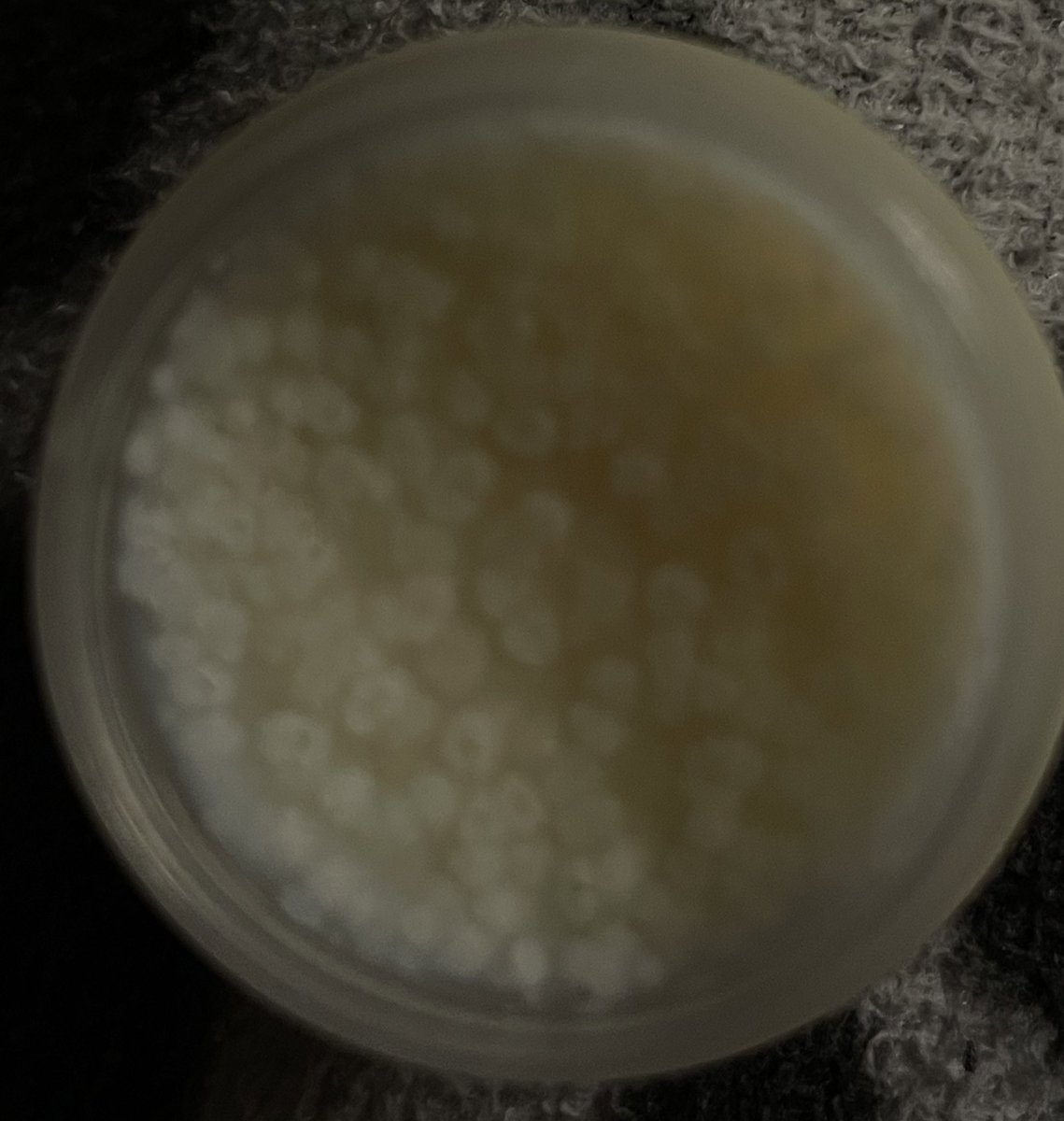 Loversenju's tweet image. Ma gueule c normal que le baume mangue aromazon que j’ai acheté il a variole du singe mdrrr 💭💭
#faut m’éclairer hein