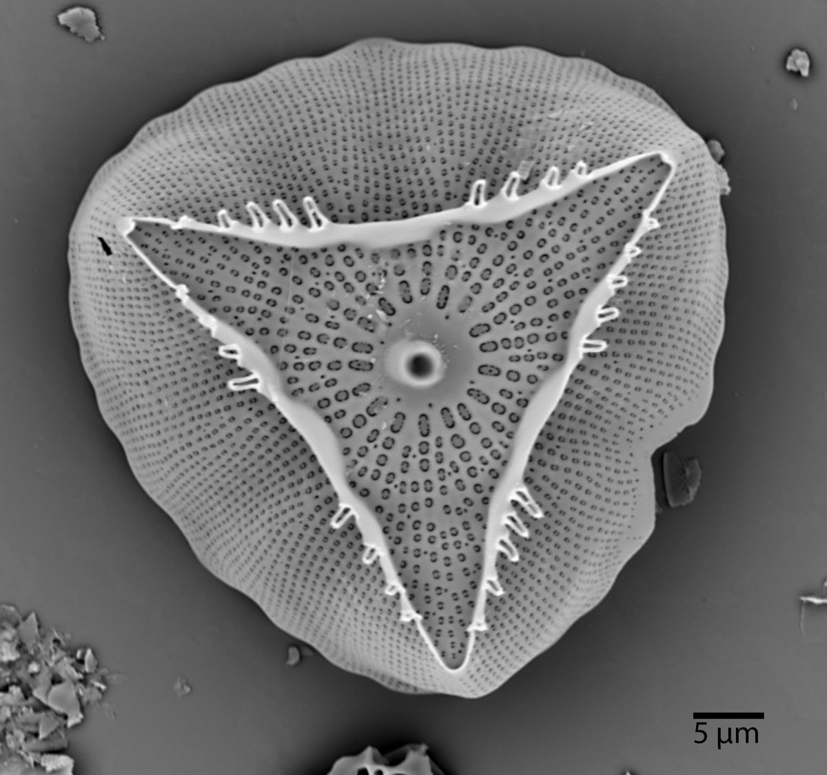 IMERSS_labs's tweet photo. Don't miss out on our silent auction featuring beautiful Salish Sea diatom imagery using scanning electron microscopes. IMERSS member, Mark Webber, donated his work and all funds will be put towards our projects at IMERSS.
Bids close October 8th noon. https://t.co/a77cJogJuh https://t.co/v80GzA3miW