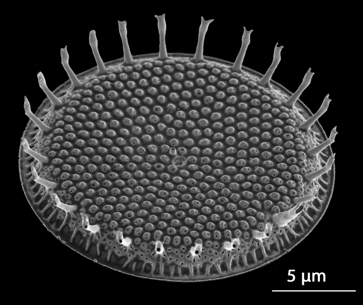 IMERSS_labs's tweet photo. Don't miss out on our silent auction featuring beautiful Salish Sea diatom imagery using scanning electron microscopes. IMERSS member, Mark Webber, donated his work and all funds will be put towards our projects at IMERSS.
Bids close October 8th noon. https://t.co/a77cJogJuh https://t.co/v80GzA3miW