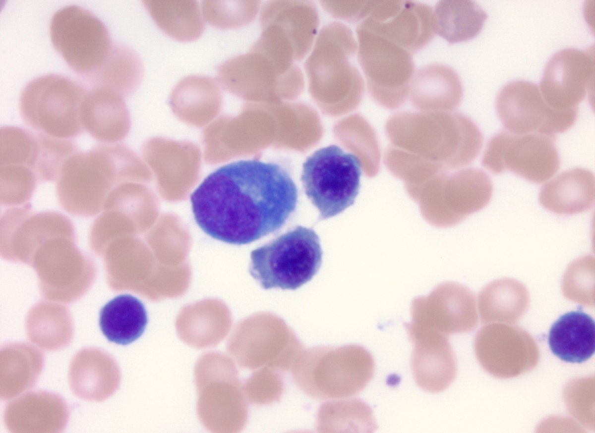 Jake Bledsoe tweet media