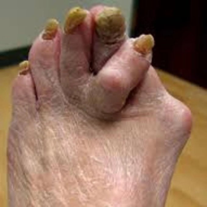 Who wants to pay for my pedicure? https://t.co/Jj7esFwhNS