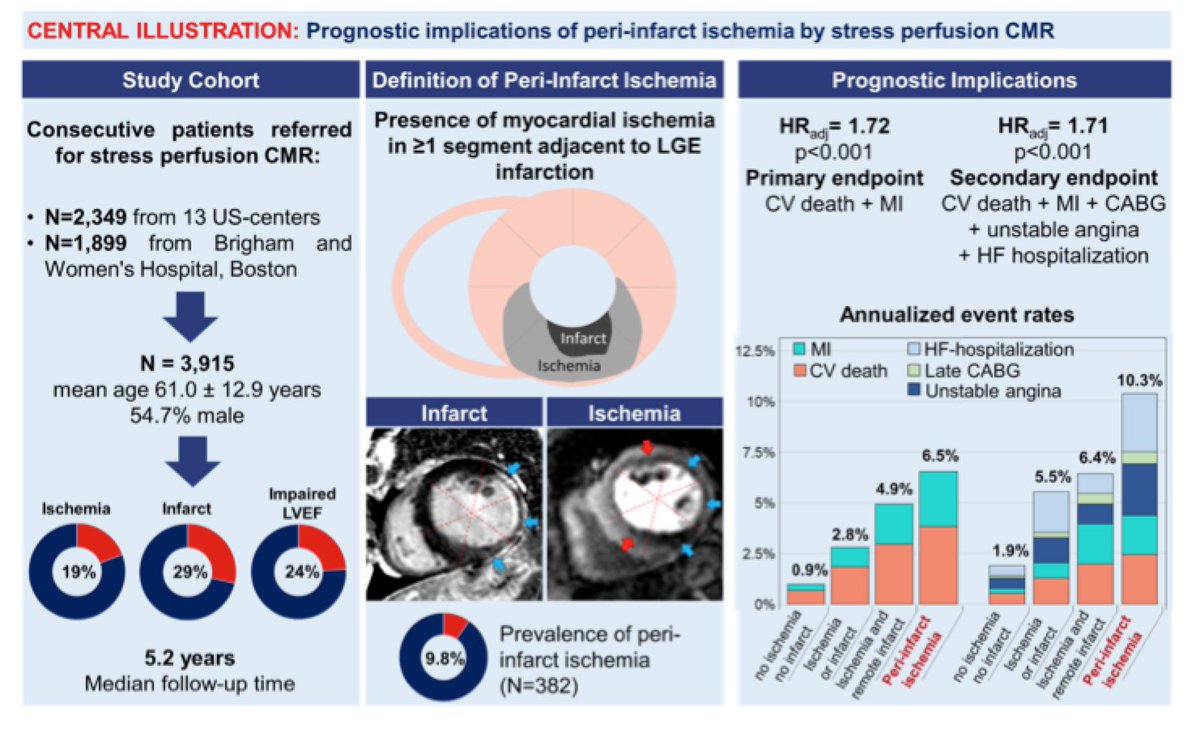 Afshin Farzaneh-Far, MD PhD (@afshinfarzan) on Twitter photo In long term follow-up of the SPINS registry "peri-infarct ischemia" assessed by stress perfusion CMR may have independent prognostic value:
jacc.org/doi/10.1016/j.…
With accompanying editorial:
jacc.org/doi/10.1016/j.…
<a href="/RKwongMD/">Raymond Kwong</a> <a href="/sven_plein/">Sven Plein</a> In long term follow-up of the SPINS registry "peri-infarct ischemia" assessed by stress perfusion CMR may have independent prognostic value:
jacc.org/doi/10.1016/j.…
With accompanying editorial:
jacc.org/doi/10.1016/j.…
<a href="/RKwongMD/">Raymond Kwong</a> <a href="/sven_plein/">Sven Plein</a>