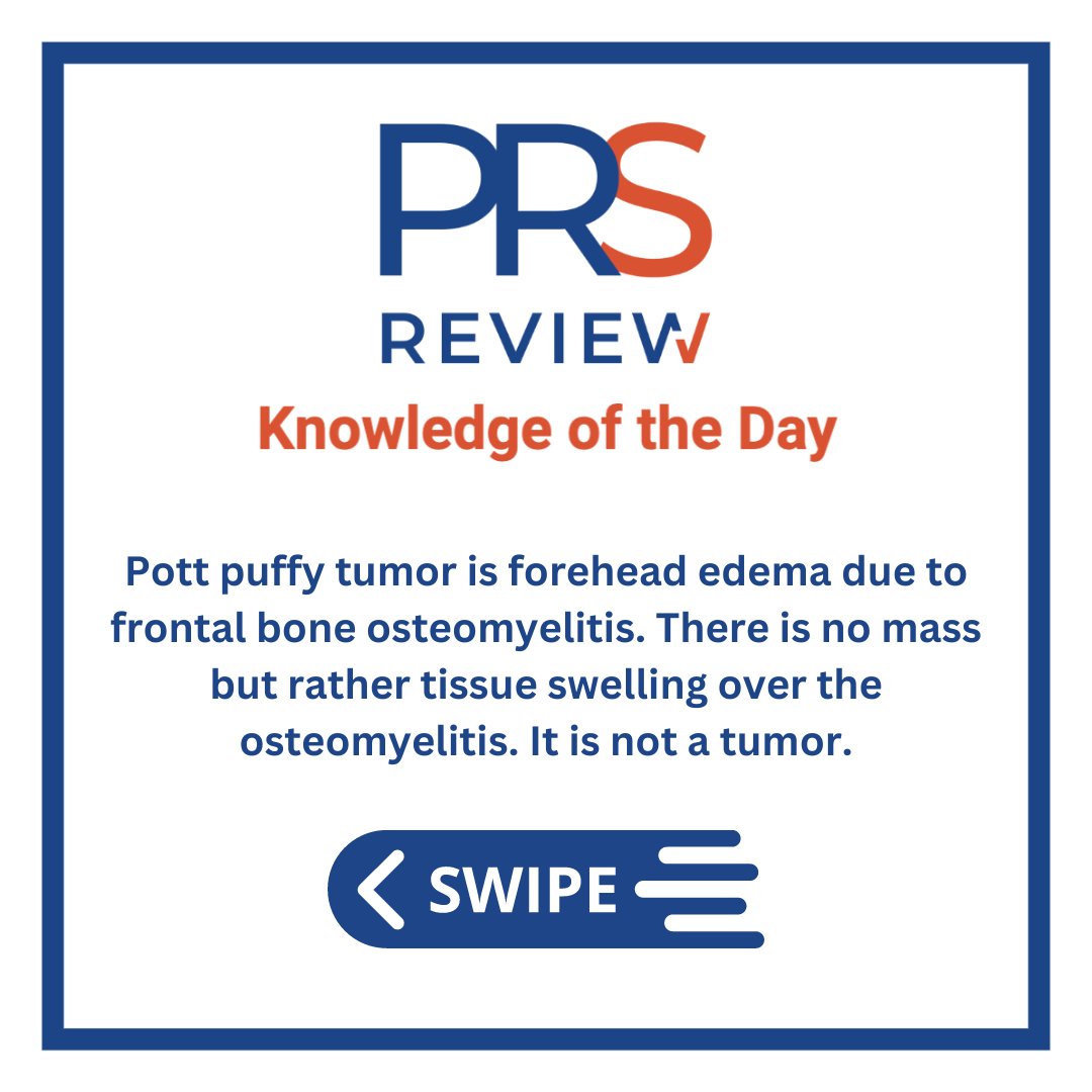 prsreview's tweet photo. Pott puffy tumor
#prsreview #pottpuffytumor #osteomyelitis #boneinfection #frontalbonefracture #facefracture #facetrauma #frontalsinus #frontalsinusitis #sinusitis #trauma #neurosurgery #craniofacialsurgery #oromaxillofacialsurgery #ENT #plasticsurgery #reconstructivesurgery https://t.co/pEzj9NfXX8