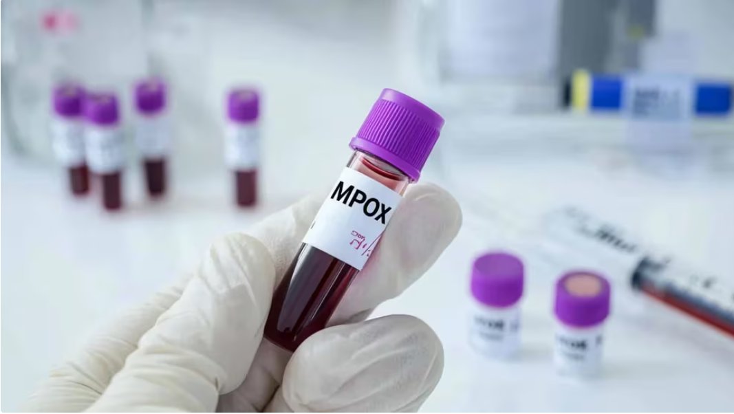 Viruela del Mono: Actualización y Medidas del Ministerio de Salud Pública de la República Dominicana vivesanord.com/viruela-del-mo…