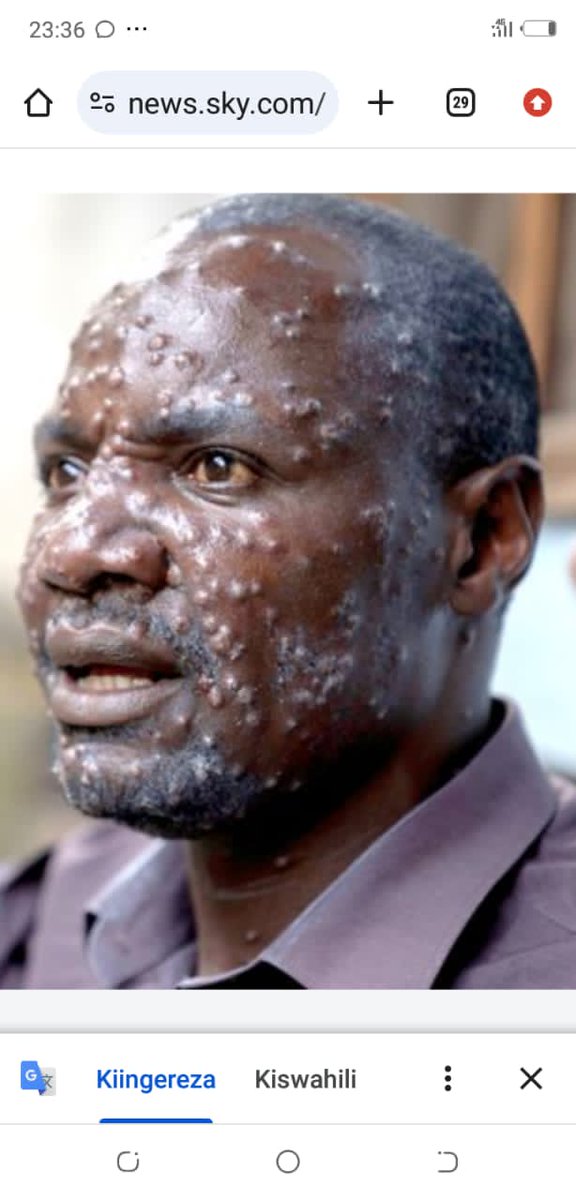 *Tahadhari za kiafya zizingatiwe.*
1. Tuepuke kusalimiana kwa mikono.
2. Tuepuke kukumbatiana.
3. Tucheze muziki kwa kutogusana.
4. Vitakasa mikono, sabuni na maji tiririka viwepo kila mahali.
5. Tunawe kila mara.
6. Tutakase mikono kila mara.
7. Virusi vya Homa ya Nyani/tumbili