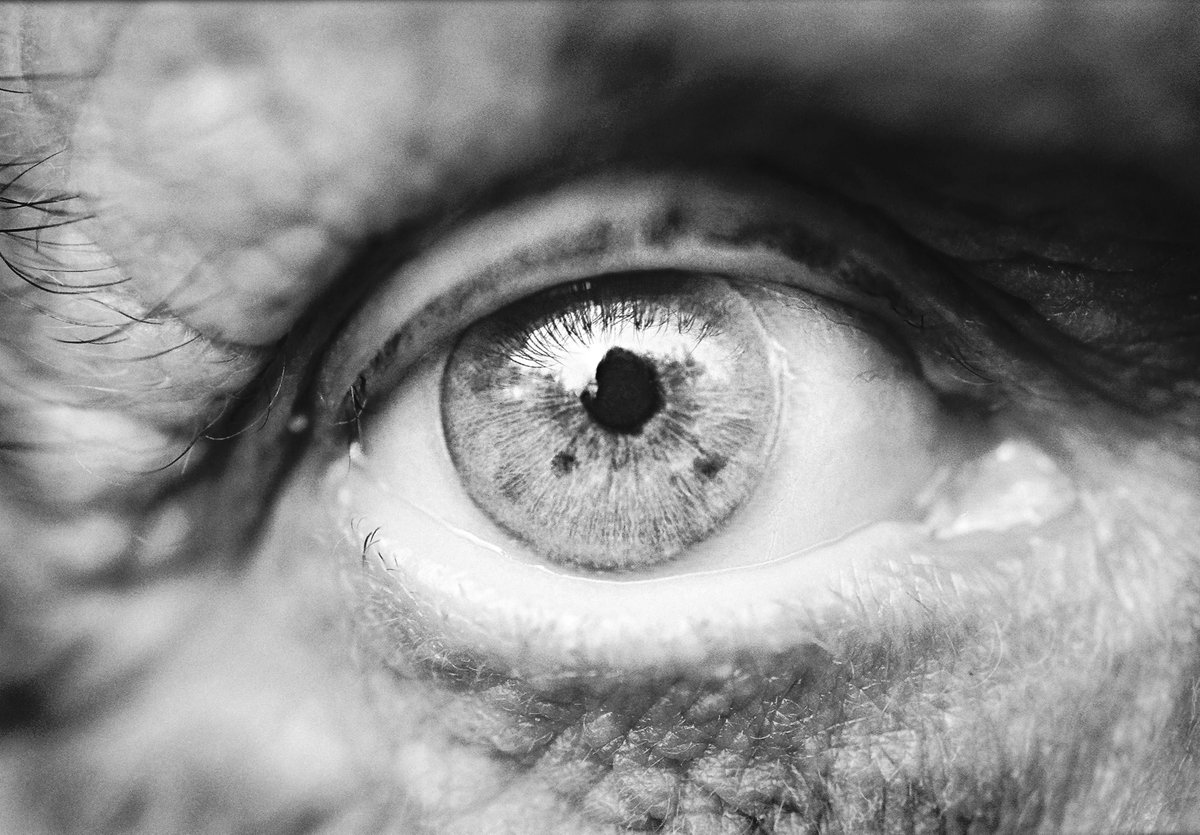 UCL Brain Sciences (@uclbrainscience) on Twitter photo New research in <a href="/ejhg_journal/">European Journal of Human Genetics</a> by <a href="/FLBraddock/">Freddie Braddock</a> & colleagues at <a href="/UCLeye/">UCL Institute of Ophthalmology</a> identified a novel missense variant in the SPARCL1 gene linked to corneal dystrophy. This research expands our knowledge of genetic eye disorders & their complexities. @AJ_Hardcastle
go.nature.com/4fXTPrl New research in <a href="/ejhg_journal/">European Journal of Human Genetics</a> by <a href="/FLBraddock/">Freddie Braddock</a> & colleagues at <a href="/UCLeye/">UCL Institute of Ophthalmology</a> identified a novel missense variant in the SPARCL1 gene linked to corneal dystrophy. This research expands our knowledge of genetic eye disorders & their complexities. @AJ_Hardcastle
go.nature.com/4fXTPrl