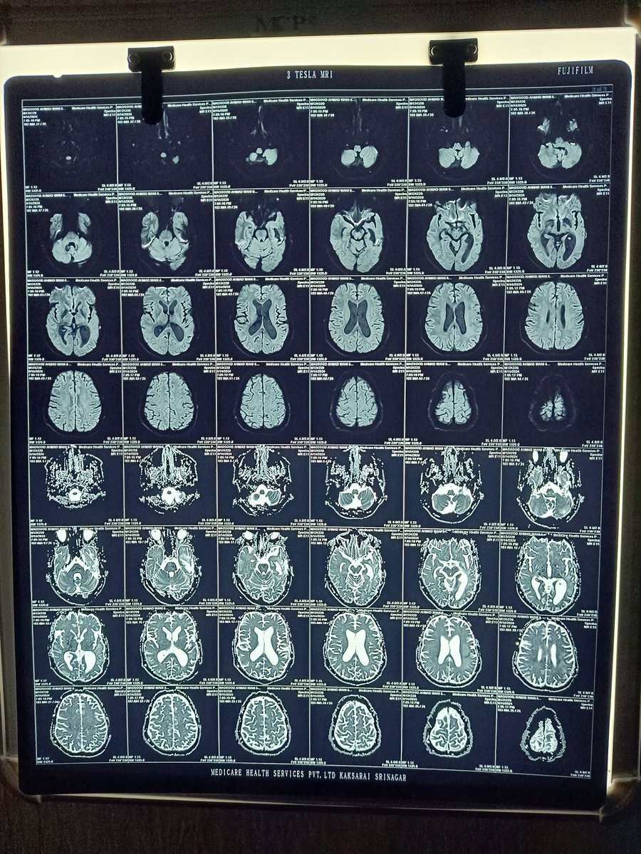 wanimasud's tweet photo. Latest MRI https://t.co/7Rlo6oF0D4
