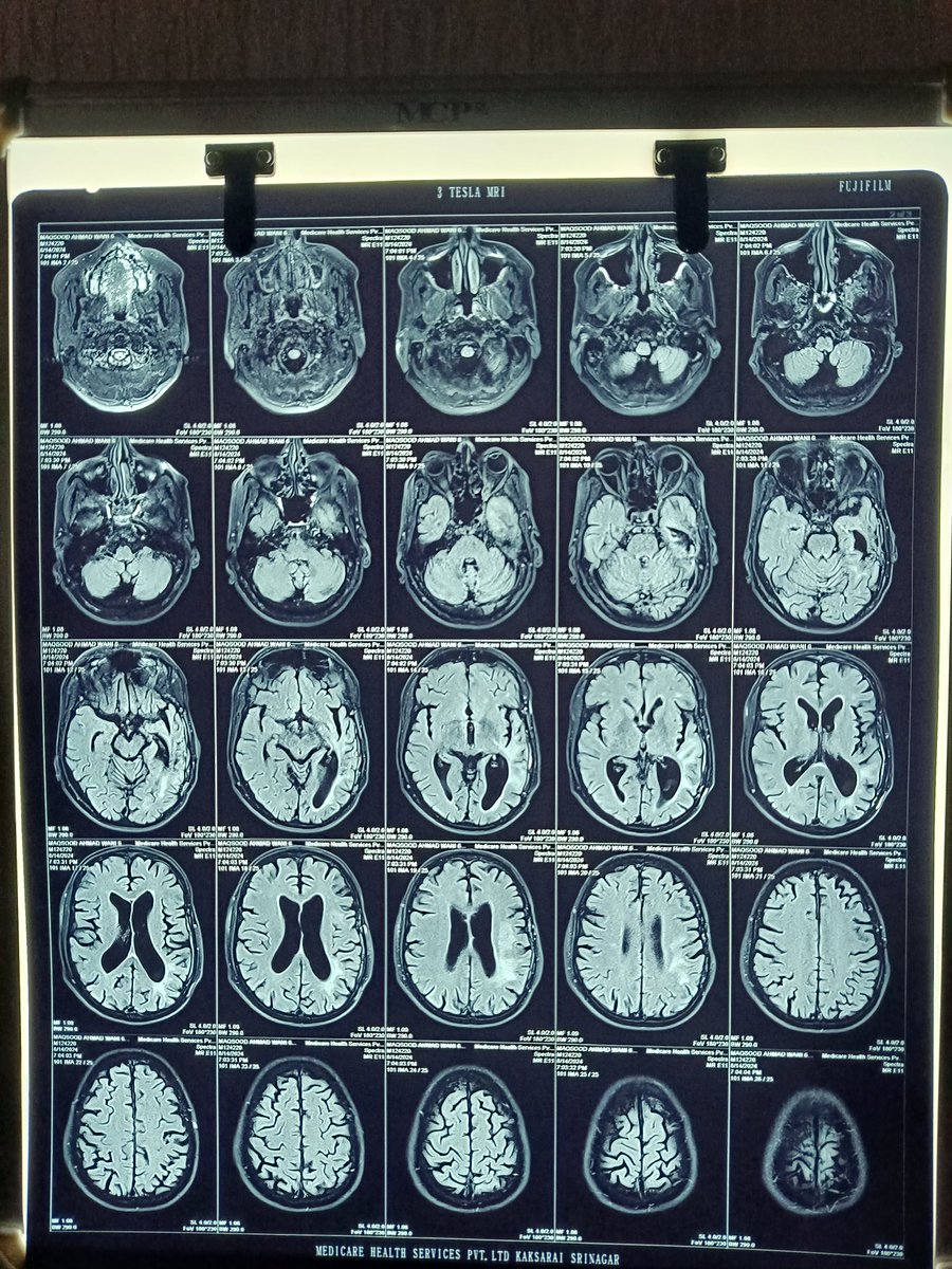 wanimasud's tweet photo. Latest MRI https://t.co/7Rlo6oF0D4