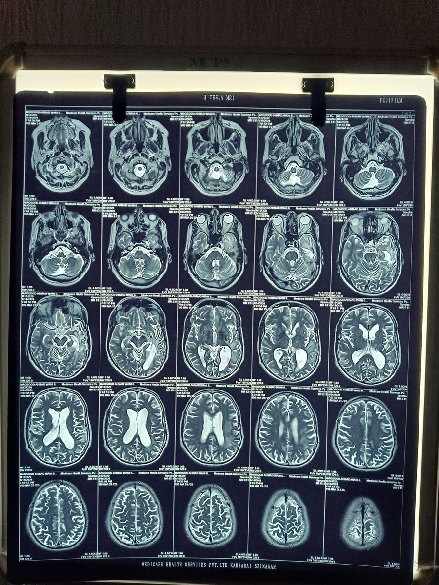 wanimasud's tweet photo. Latest MRI https://t.co/7Rlo6oF0D4