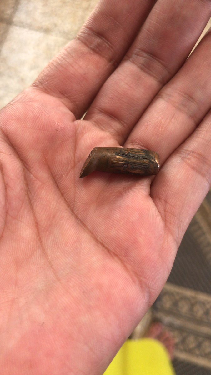RewaaAbed's tweet photo. I spent two days in the hospital with my one-year-old daughter who suffered from a drop in blood sugar and gastroenteritis due to poor food quality in Gaza. “Her hospitalisation saved our lives because they bombed our neighbour’s house. Many fragments and lead entered our house.” https://t.co/BFDwNn4Ccs