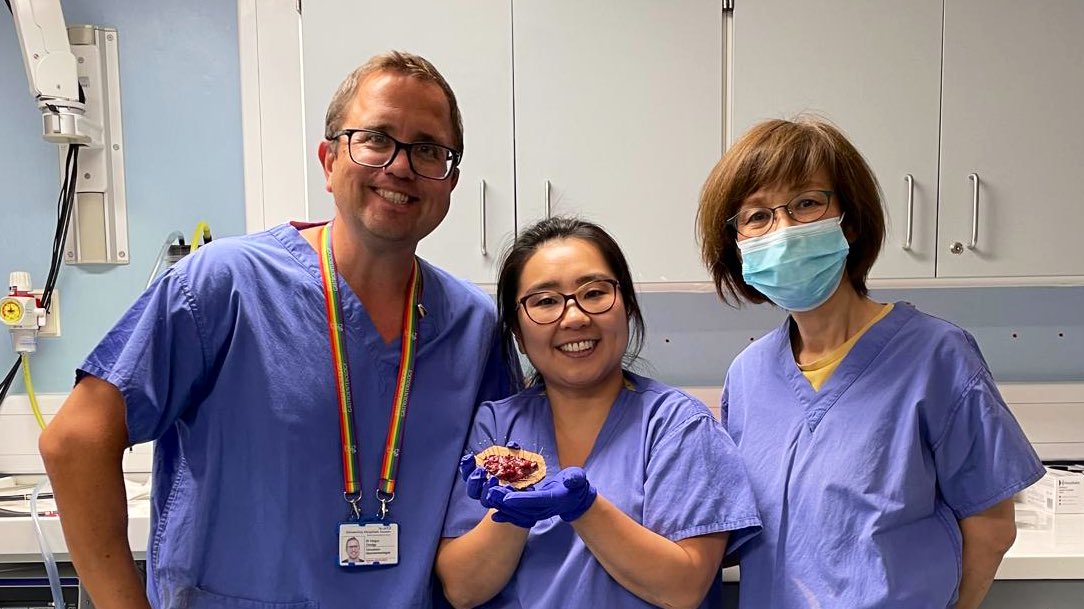 Sun Mi Ha (@sunmiha1) on Twitter photo A great day doing ESD with <a href="/NorikoSuzuki3/">Dr Noriko Suzuki 💙</a> (fantastic mentor, role model and Polyp Queen) and <a href="/ferguschedgy/">Fergus Chedgy</a> (Gastroenterologist) #advanced #polypectomy #SWiG #endoscopists #UHSussex A great day doing ESD with <a href="/NorikoSuzuki3/">Dr Noriko Suzuki 💙</a> (fantastic mentor, role model and Polyp Queen) and <a href="/ferguschedgy/">Fergus Chedgy</a> (Gastroenterologist) #advanced #polypectomy #SWiG #endoscopists #UHSussex