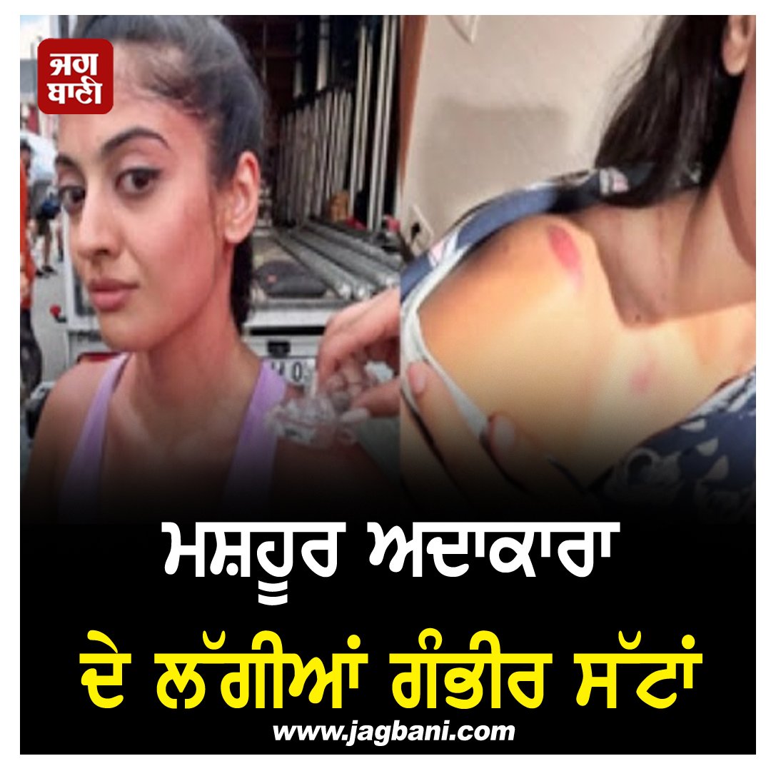 JagbaniOnline's tweet photo. ਮਸ਼ਹੂਰ ਅਦਾਕਾਰਾ ਦੇ ਲੱਗੀਆਂ ਗੰਭੀਰ ਸੱਟਾਂ, ਤਸਵੀਰਾਂ ਕੀਤੀਆਂ ਸਾਂਝੀਆਂ
https://t.co/q5tpwR8emZ
#TVActress #AditiSharma #SeriousInjuries #SharedPictures #KhatronkeKhiladi #Jagbani https://t.co/v9EtPazyhU